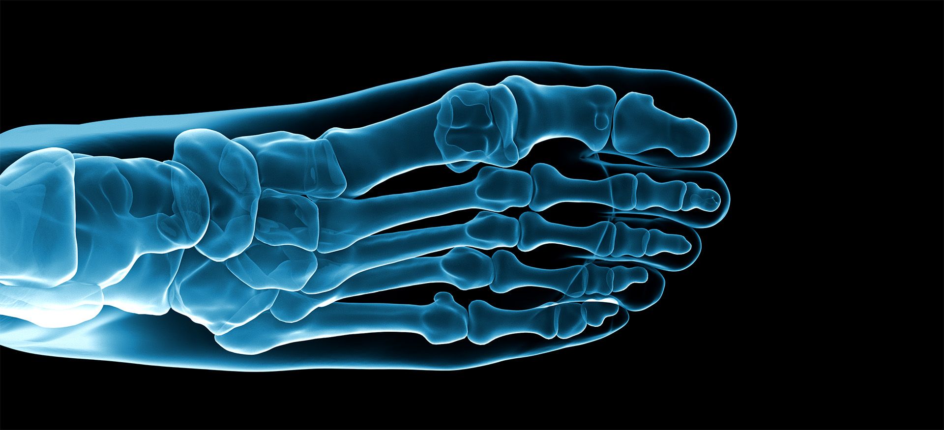 Implants and Implant Systems Foot Surgery