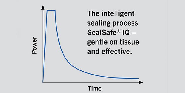 Sealing Progress