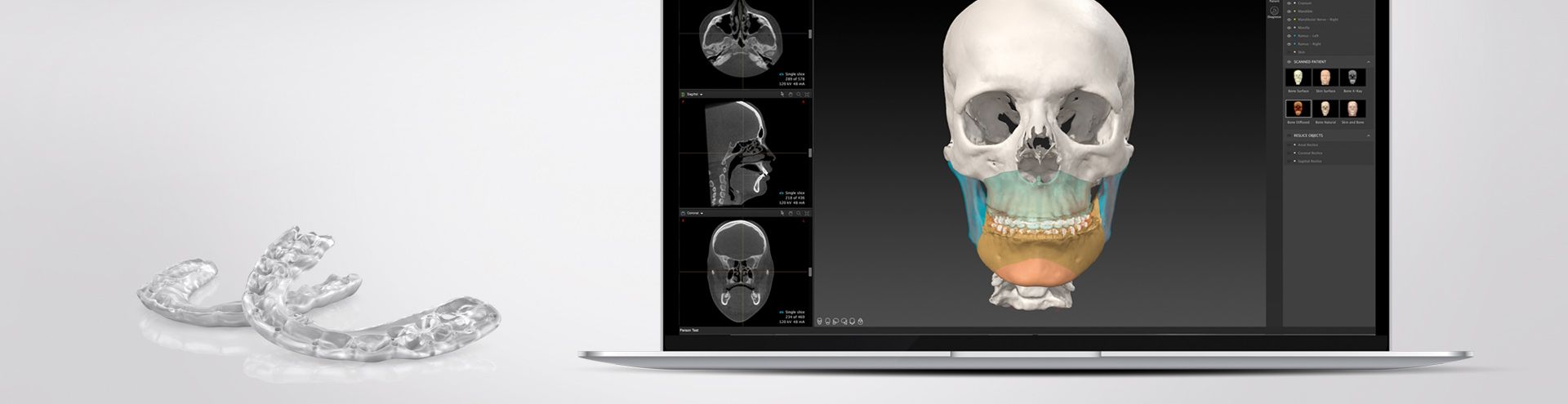 State-of-the-art in 3D Virtual Planning in Orthognathic Surgery